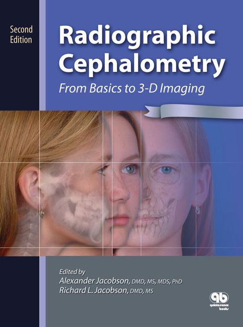 Cover image for book Radiographic Cephalometry