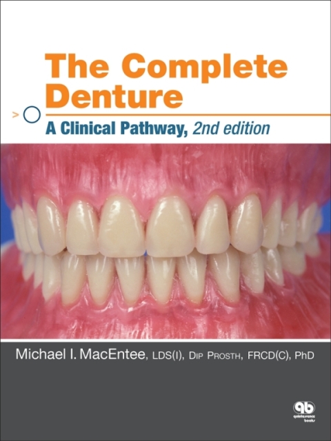 Cover image for book The Complete Denture: A Clinical Pathway, Second Edition