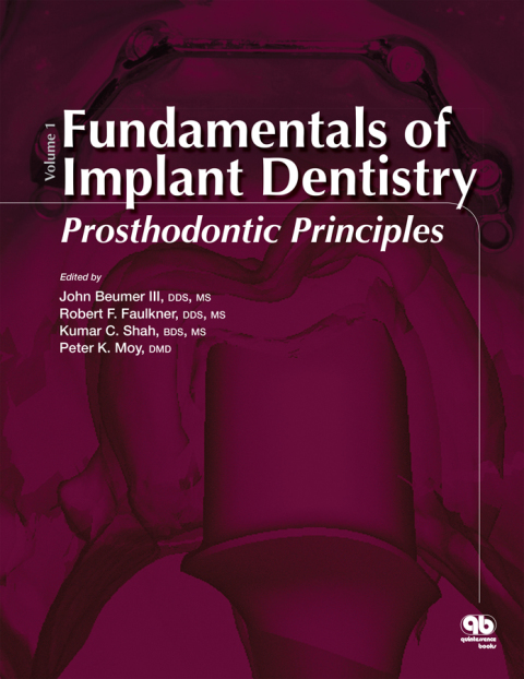 Cover image for book Fundamentals of Implant Dentistry, Volume 1: Prosthodontic Principles