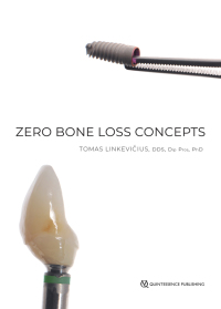 Cover image: Zero Bone Loss Concepts 1st edition 9780867157994
