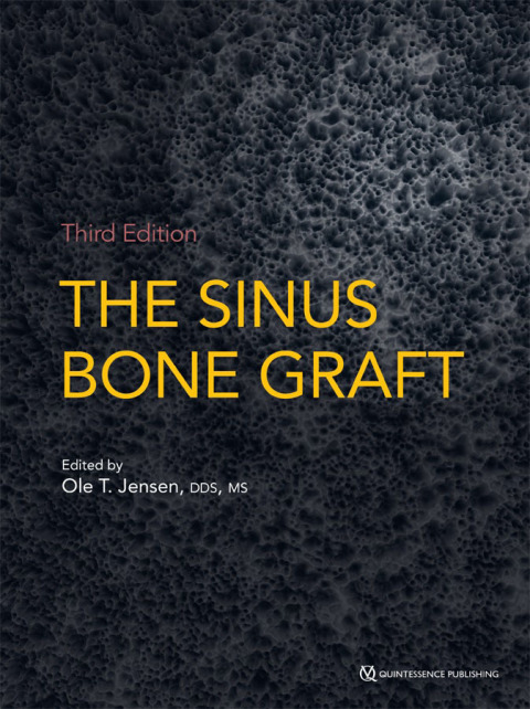 Cover image for book The Sinus Bone Graft, Third Edition