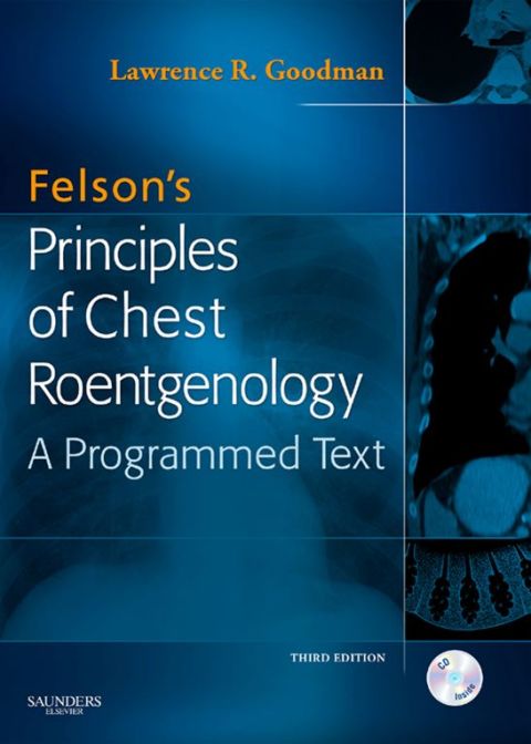 Cover image for book Felson's Principles of Chest Roentgenology