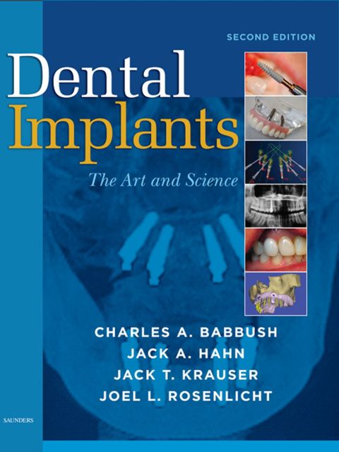 Cover image for book Dental Implants