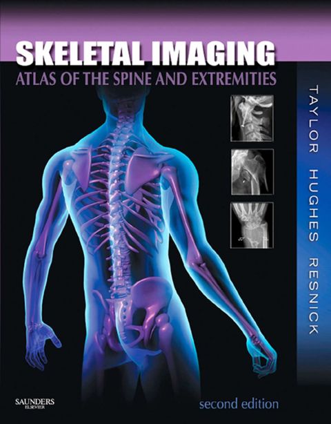 Cover image for book Skeletal Imaging