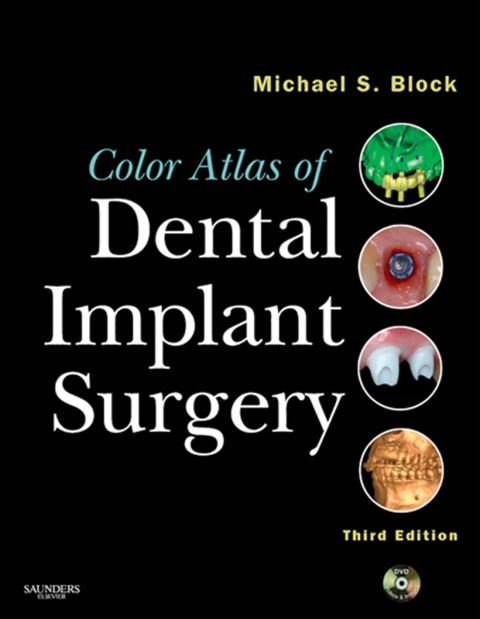 Cover image for book Color Atlas of Dental Implant Surgery