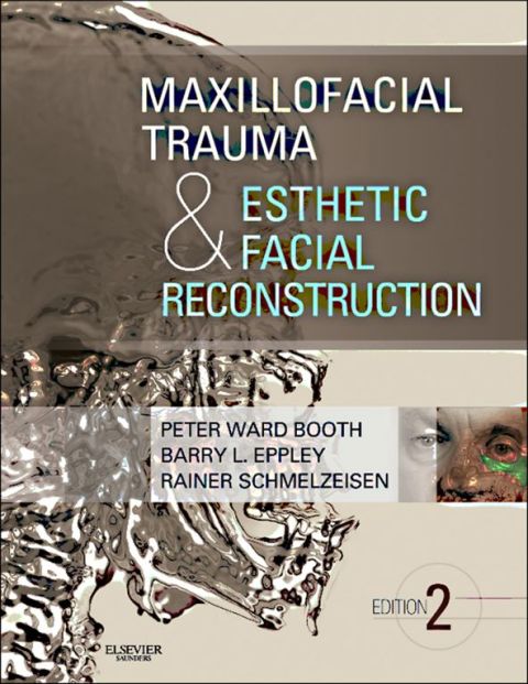 Cover image for book Maxillofacial Trauma and Esthetic Facial Reconstruction