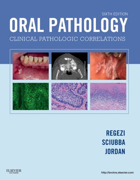 Cover image for book Oral Pathology