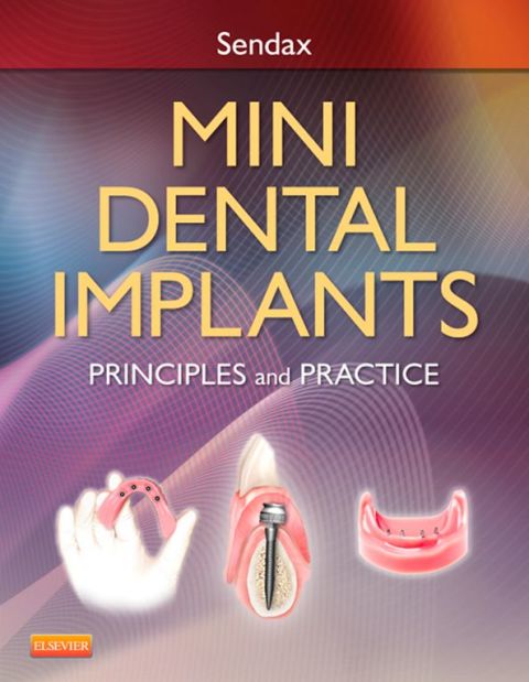 Cover image for book Mini Dental Implants