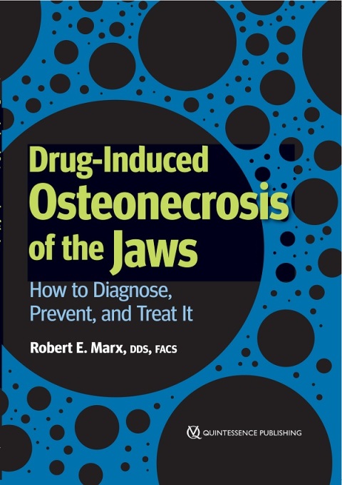Cover image for book Drug-Induced Osteonecrosis of the Jaws: How to Diagnose, Prevent, and Treat It