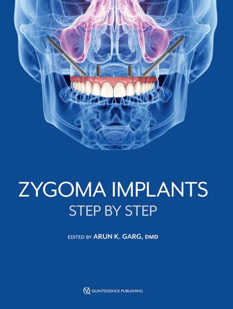 Cover image for book Zygoma Implants: Step by Step