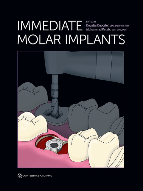 Cover image for book Immediate Molar Implants