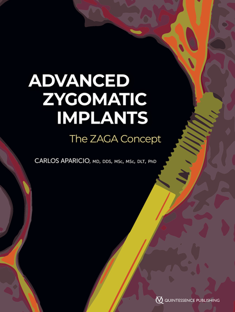 Cover image for book Zygomatic Implants:The Anatomy Guided Approach
