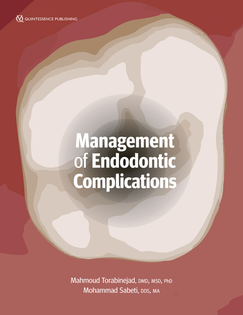 Cover image for book Management of Endodontic Complications: From Diagnosis to Prognosis