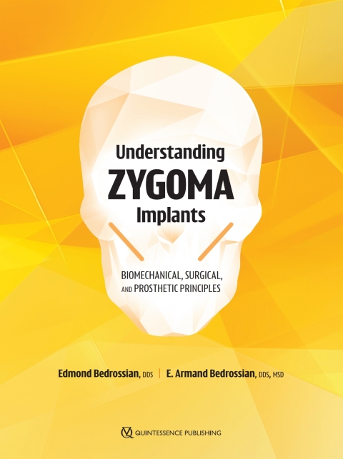 Cover image for book Understanding Zygoma Implants: Biomechanical, Surgical, and Prosthetic Principles