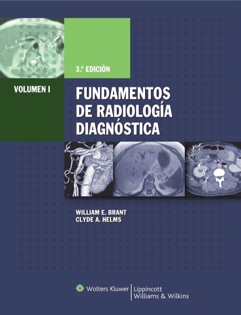 Cover image for book Fundamentos de Radiologia Diagnostica