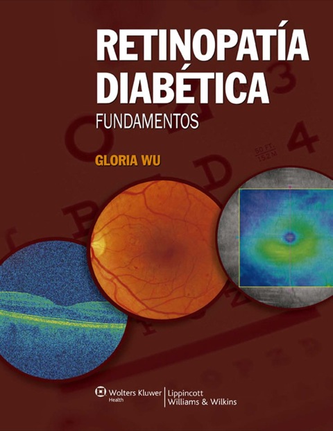 Retinopatía diabética. Fundamentos
