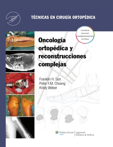 Cover image for book Técnicas en cirugía ortopédica. Oncología ortopédica y reconstrucciones complejas