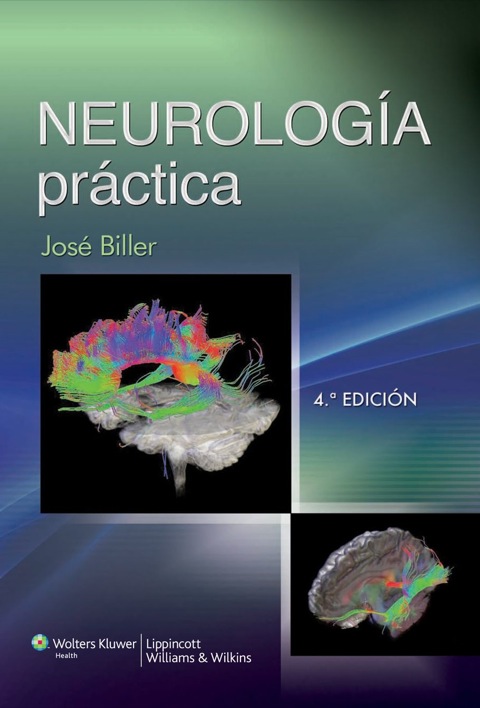 Neurología práctica