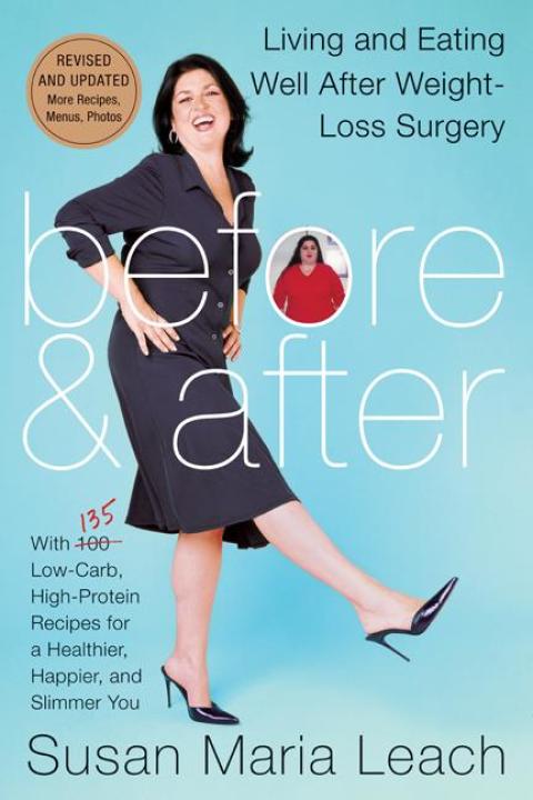 Cover image for book Before & After, Revised Edition