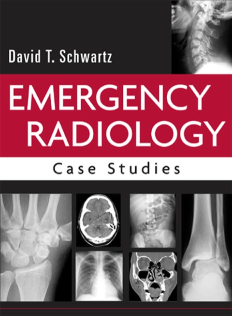Cover image for book Emergency Radiology: Case Studies