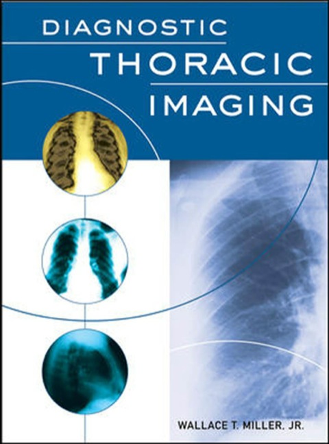 Cover image for book Diagnostic Thoracic Imaging