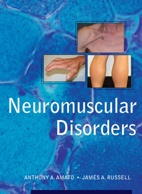 Cover image for book Neuromuscular Disorders