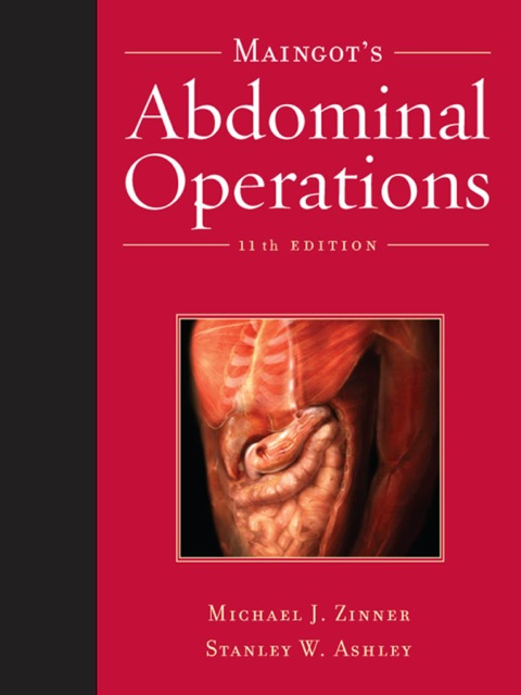 Cover image for book Maingot's Abdominal Operations