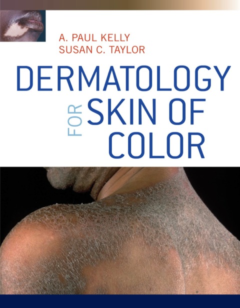 Cover image for book Dermatology for Skin of Color
