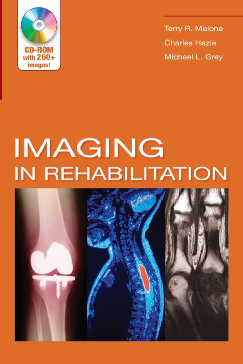 Cover image for book Imaging In Rehabilitation