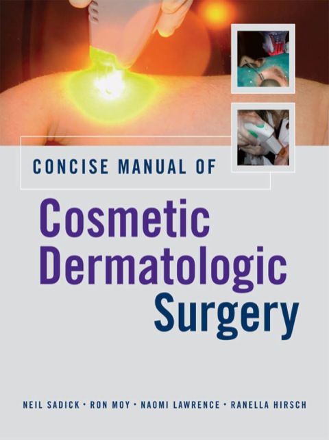 Cover image for book Concise Manual of Cosmetic Dermatologic Surgery