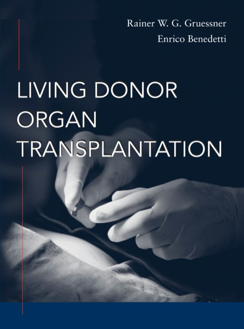Cover image for book Living Donor Organ Transplantation