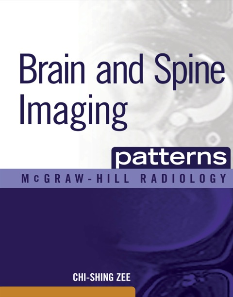 Cover image for book Brain and Spine Imaging Patterns