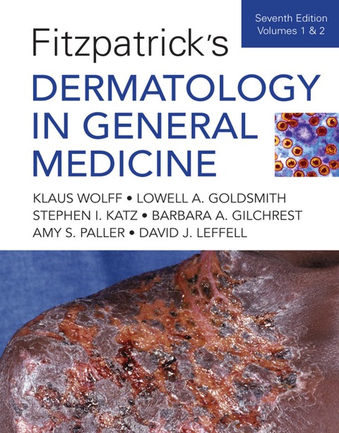 Cover image for book Fitzpatrick's Dermatology In General Medicine