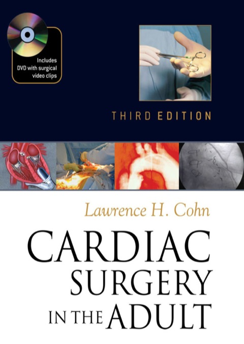 Cover image for book Cardiac Surgery in the Adult