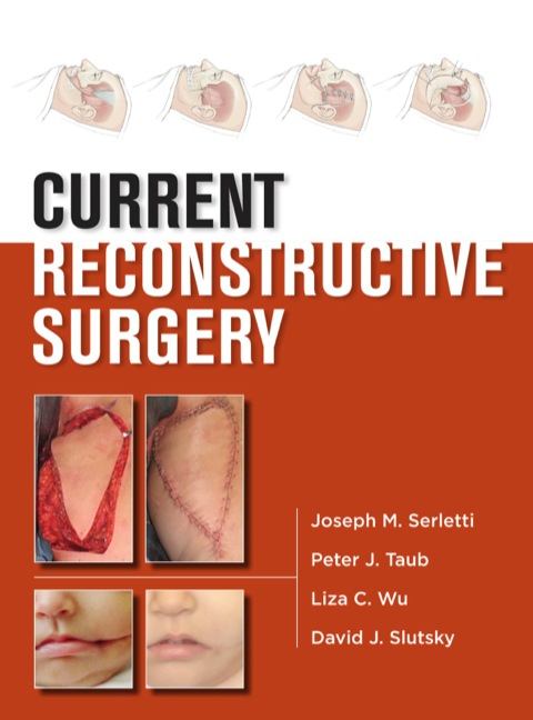Cover image for book Current Reconstructive Surgery