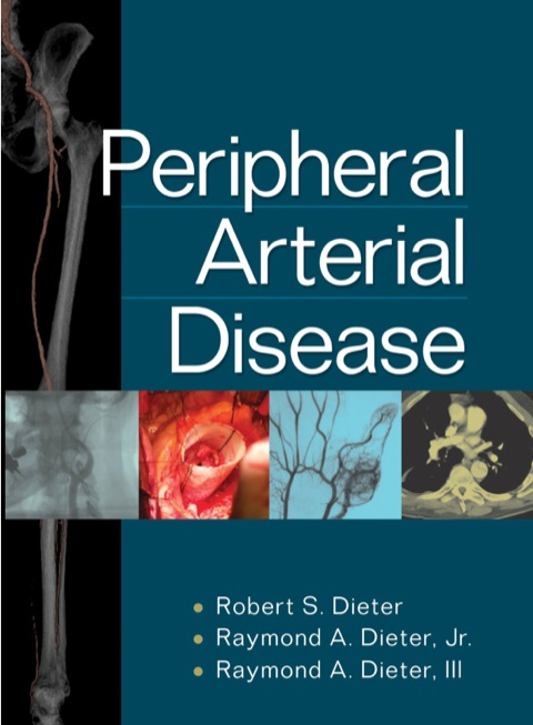Cover image for book Peripheral Arterial Disease