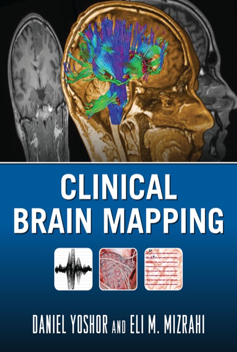 Cover image for book Clinical Brain Mapping