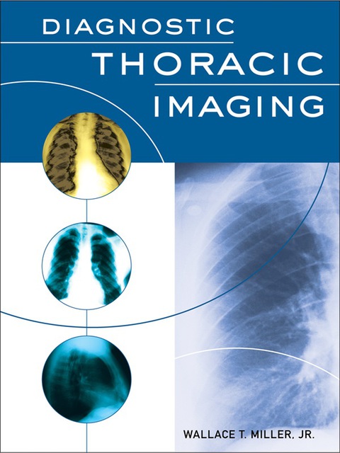Cover image for book Diagnostic Thoracic Imaging