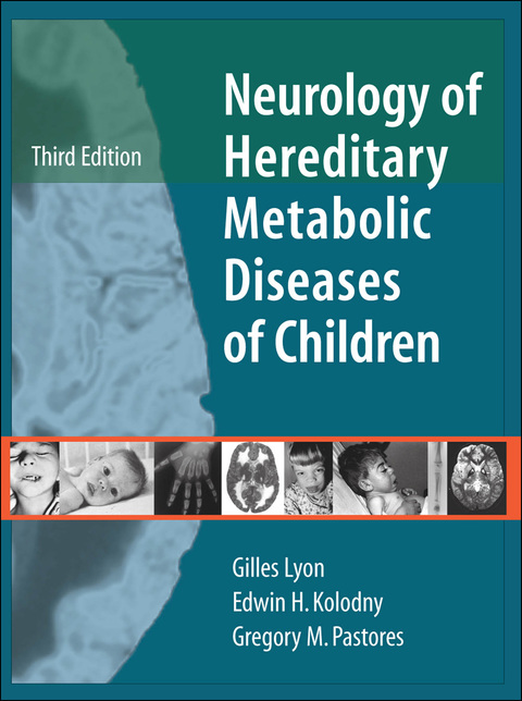 Cover image for book Neurology of Hereditary Metabolic Diseases of Children: Third Edition