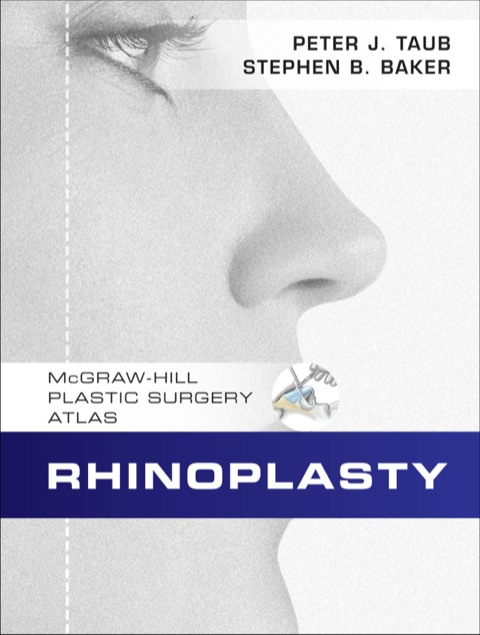 Cover image for book Rhinoplasty