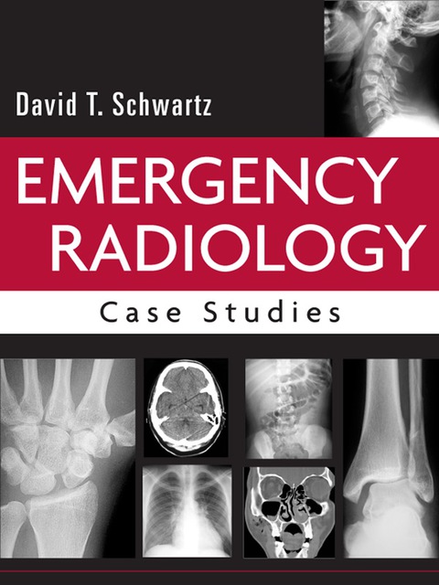 Cover image for book Emergency Radiology: Case Studies