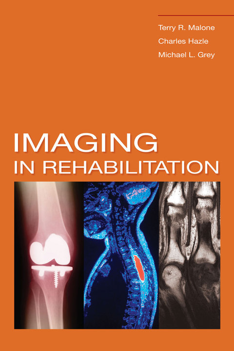 Cover image for book Imaging In Rehabilitation