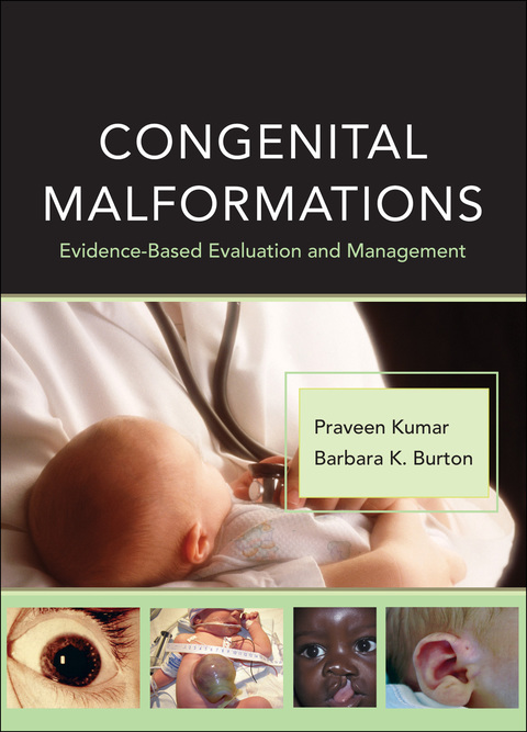 Cover image for book Congenital Malformations: Evidence-Based Evaluation and Management