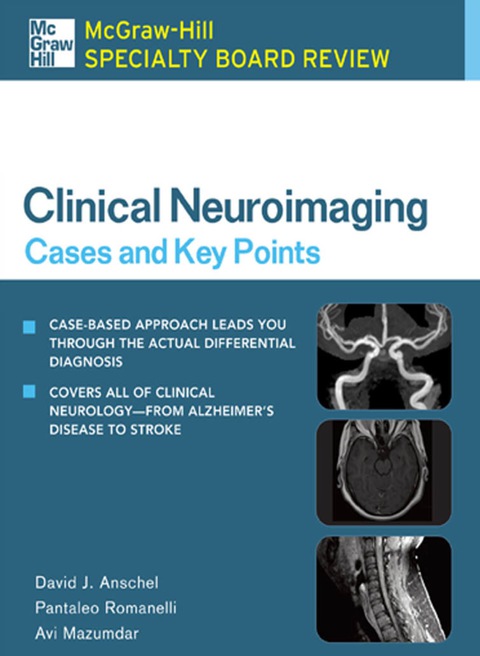 Cover image for book McGraw-Hill Specialty Board Review Clinical Neuroimaging: Cases and Key Points