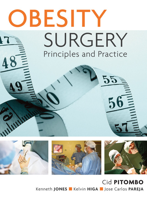 Cover image for book Obesity Surgery: Principles and Practice