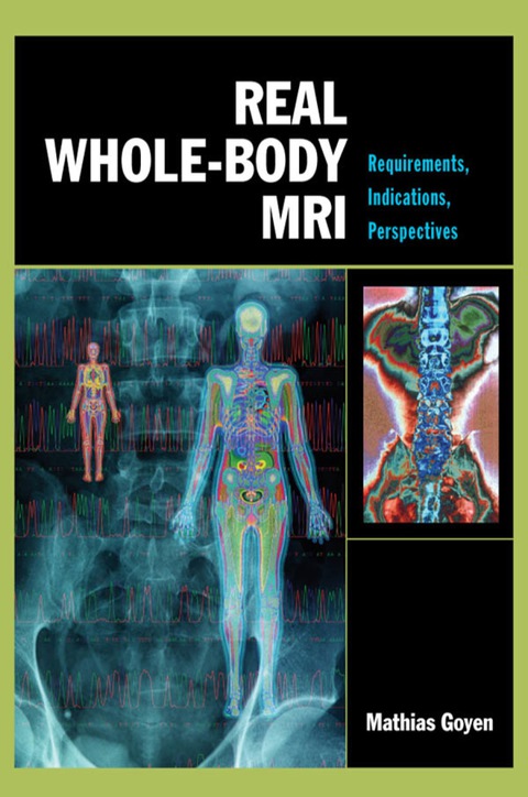 Cover image for book Real Whole-Body MRI: Requirements, Indications, Perspectives
