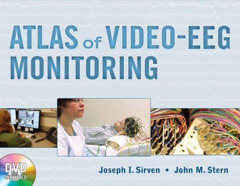 Cover image for book Atlas of Video-EEG Monitoring