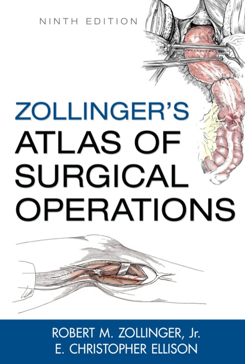 Cover image for book Zollinger's Atlas of Surgical Operations
