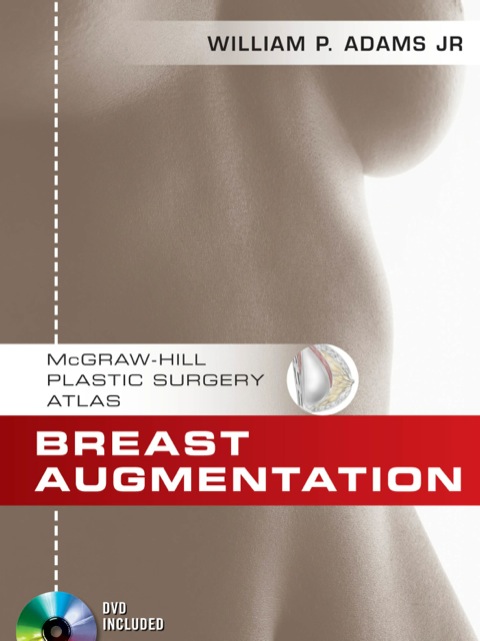 Cover image for book Breast Augmentation