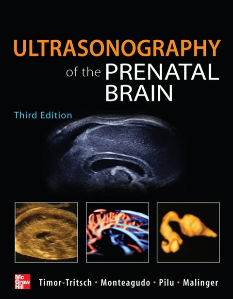 Cover image for book Ultrasonography of the Prenatal Brain